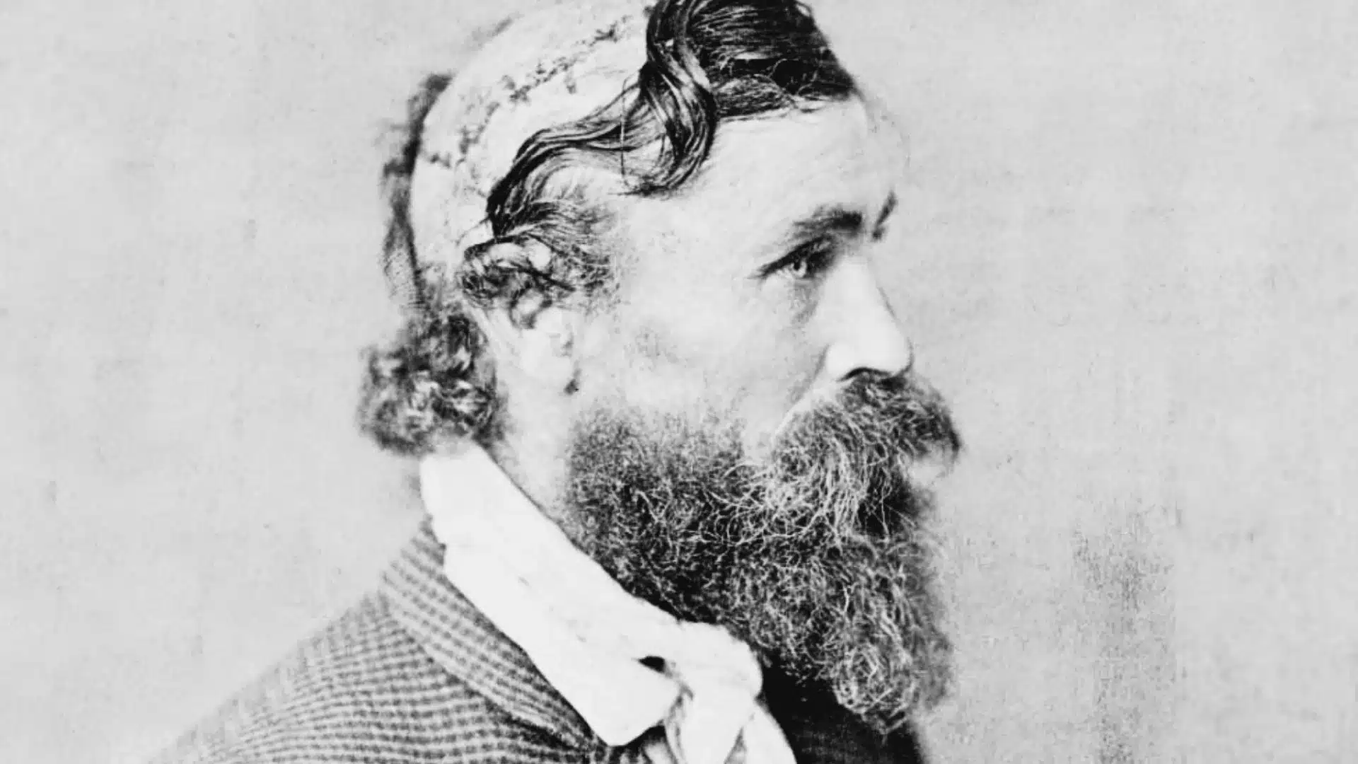 Portrait of man with beard and visible scalp injury, historical photo showing serious facial expression